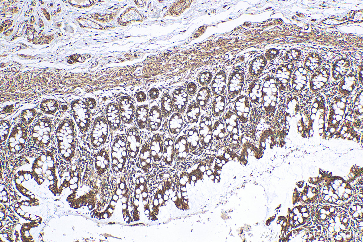 Immunohistochemistry (IHC) staining of human colon tissue using ARHGAP15 Polyclonal antibody (11940-1-AP)