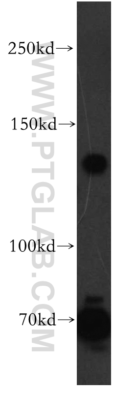 Western Blot (WB) analysis of human brain tissue using ARHGAP20 Polyclonal antibody (13775-1-AP)