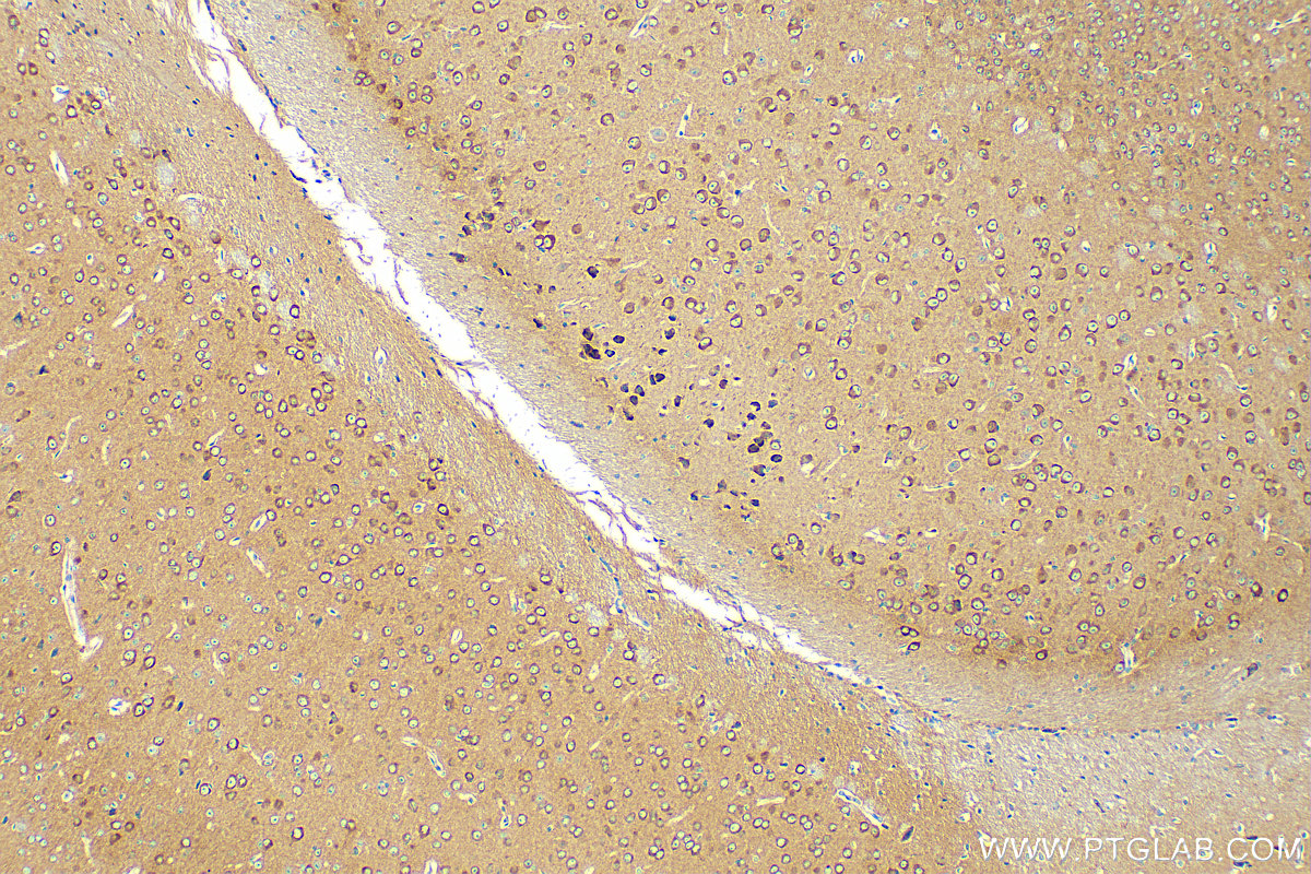 Immunohistochemistry (IHC) staining of mouse brain tissue using GRAF Polyclonal antibody (17747-1-AP)