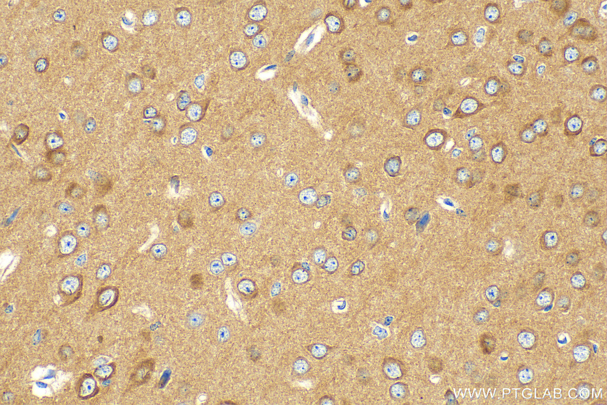 Immunohistochemistry (IHC) staining of mouse brain tissue using GRAF Polyclonal antibody (17747-1-AP)