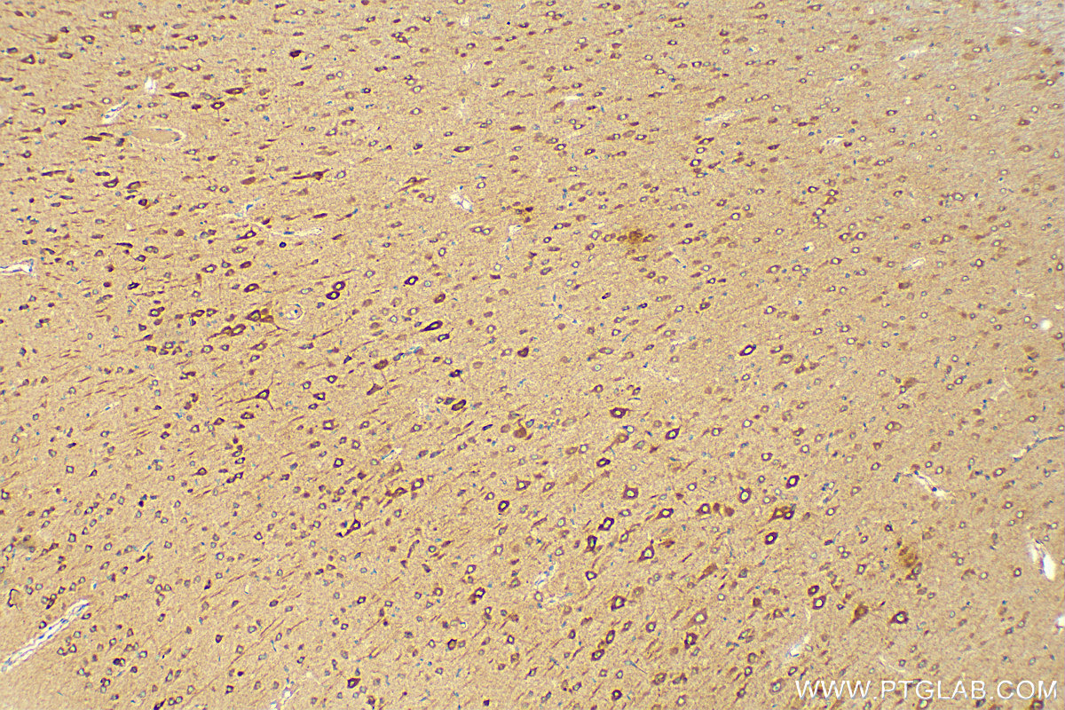 Immunohistochemistry (IHC) staining of rat brain tissue using GRAF Polyclonal antibody (17747-1-AP)