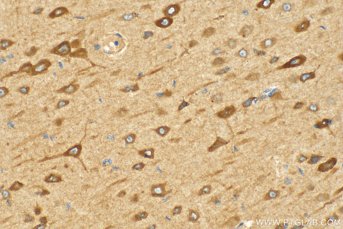 Immunohistochemistry (IHC) staining of rat brain tissue using GRAF Polyclonal antibody (17747-1-AP)