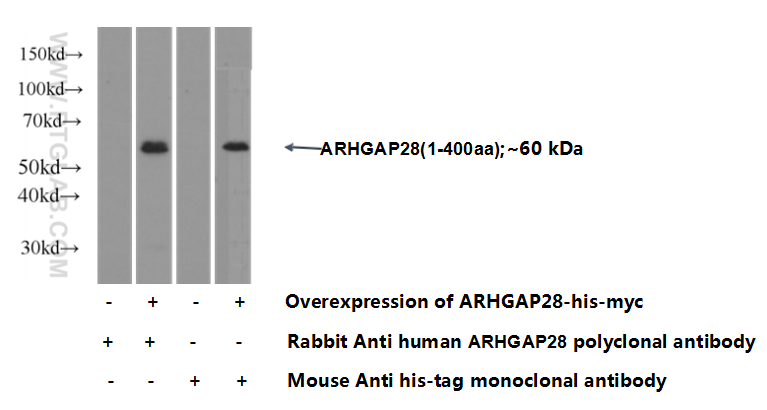 ARHGAP28