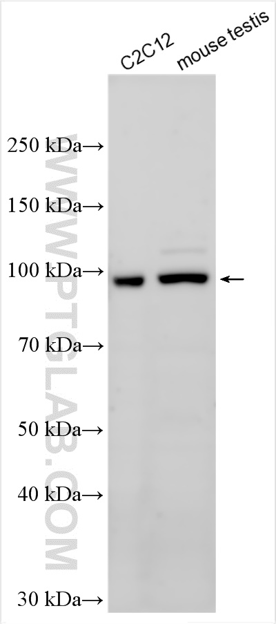 Western Blot (WB) analysis of various lysates using ARHGAP28 Polyclonal antibody (26766-1-AP)