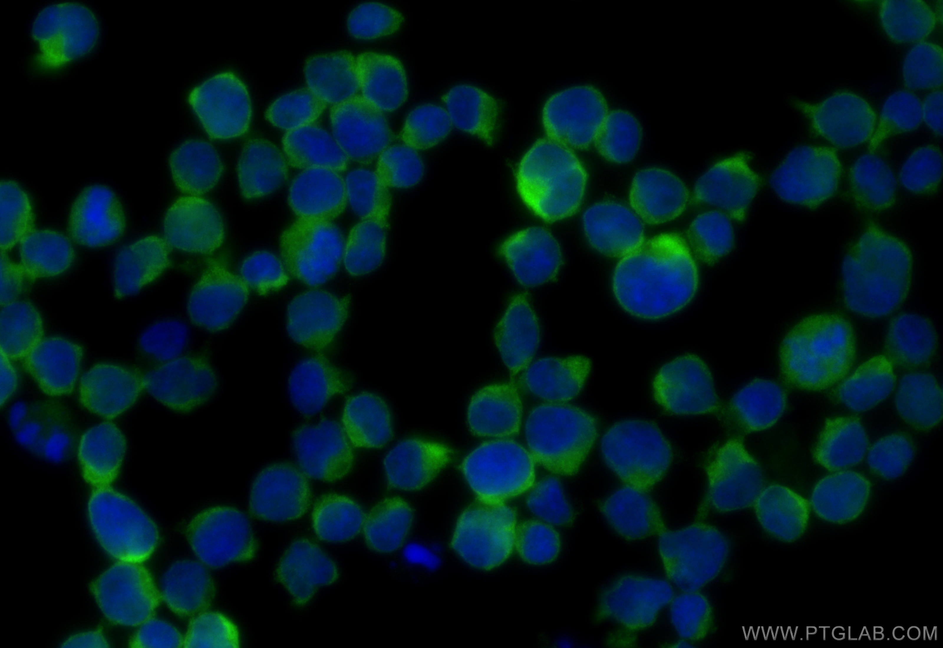 Immunofluorescence (IF) / fluorescent staining of Jurkat cells using ARHGAP4 Polyclonal antibody (16697-1-AP)