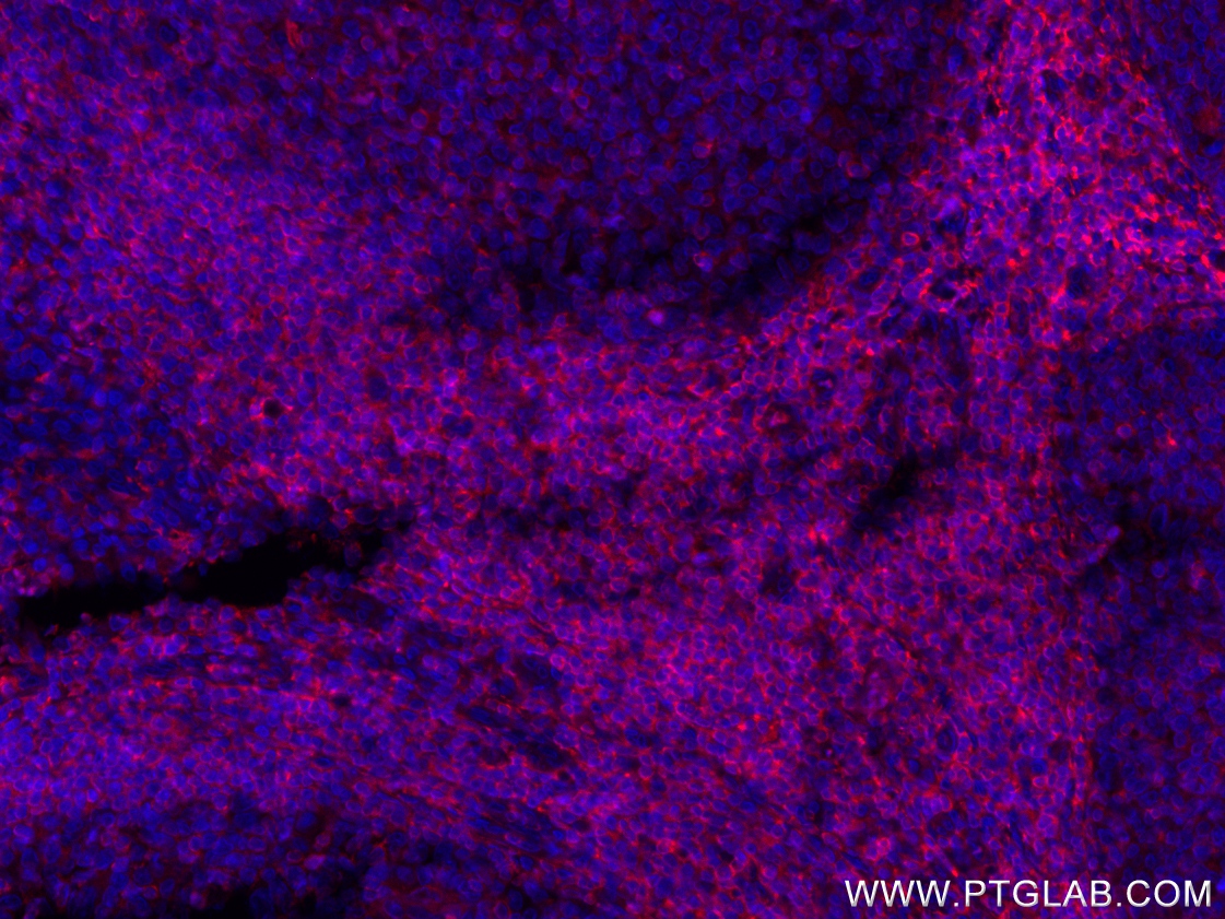 Immunofluorescence (IF) / fluorescent staining of human tonsillitis tissue using CoraLite®594-conjugated ARHGDIB Monoclonal antibod (CL594-66054)