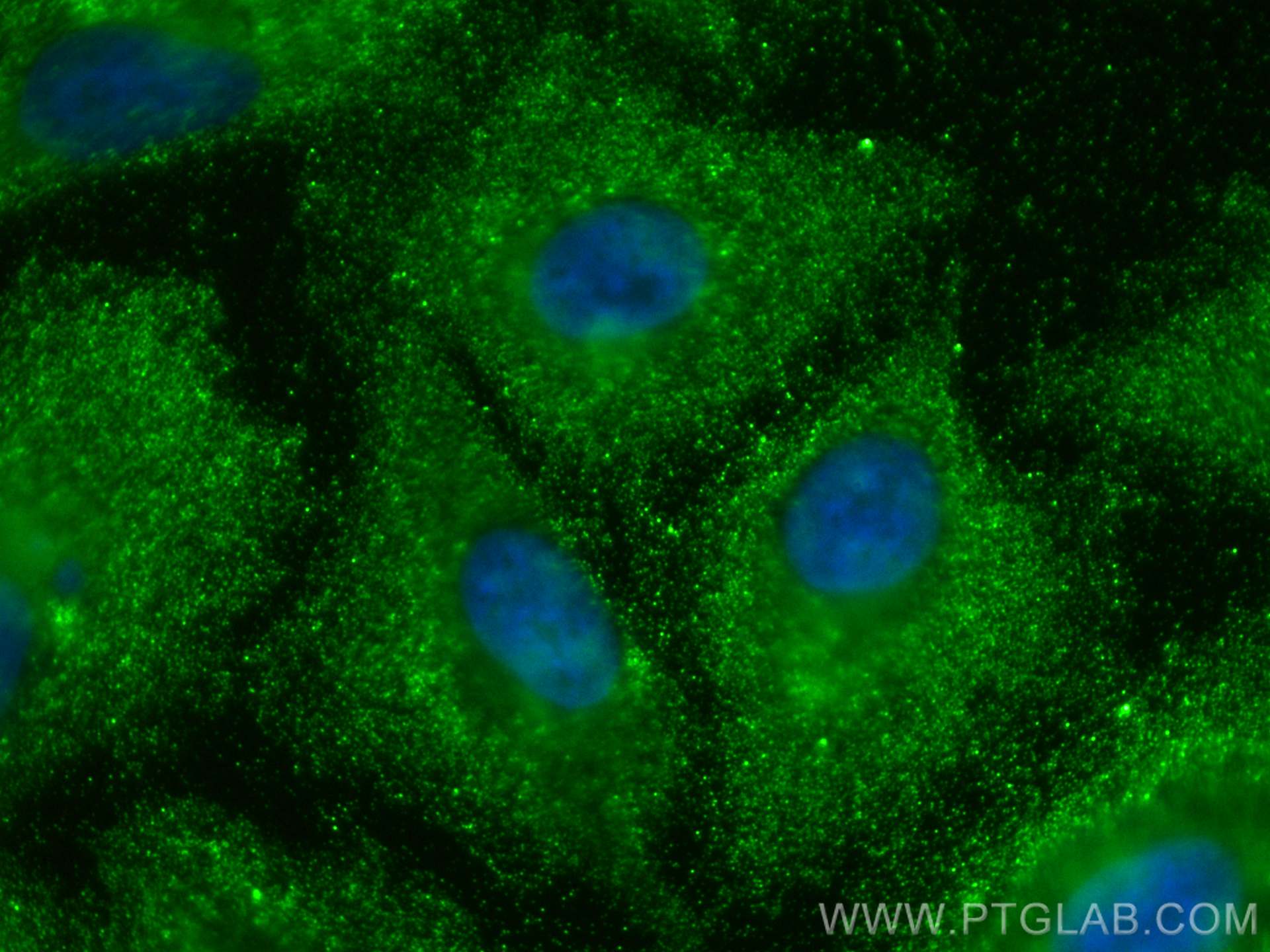 Immunofluorescence (IF) / fluorescent staining of A549 cells using ARHGEF1 Polyclonal antibody (11363-1-AP)