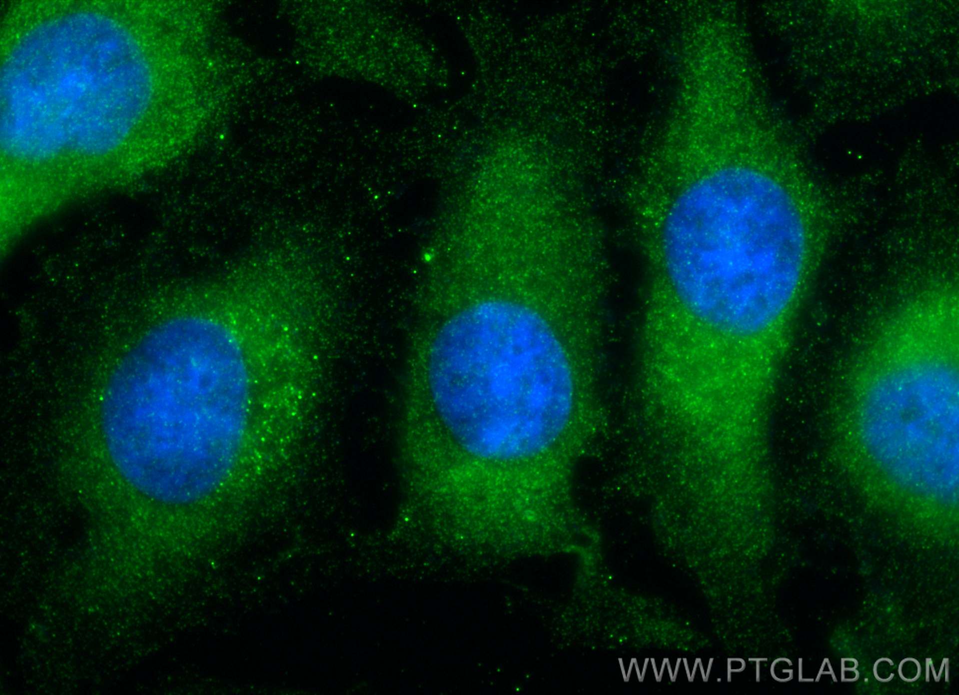 Immunofluorescence (IF) / fluorescent staining of HeLa cells using ARHGEF16 Monoclonal antibody (67975-1-Ig)