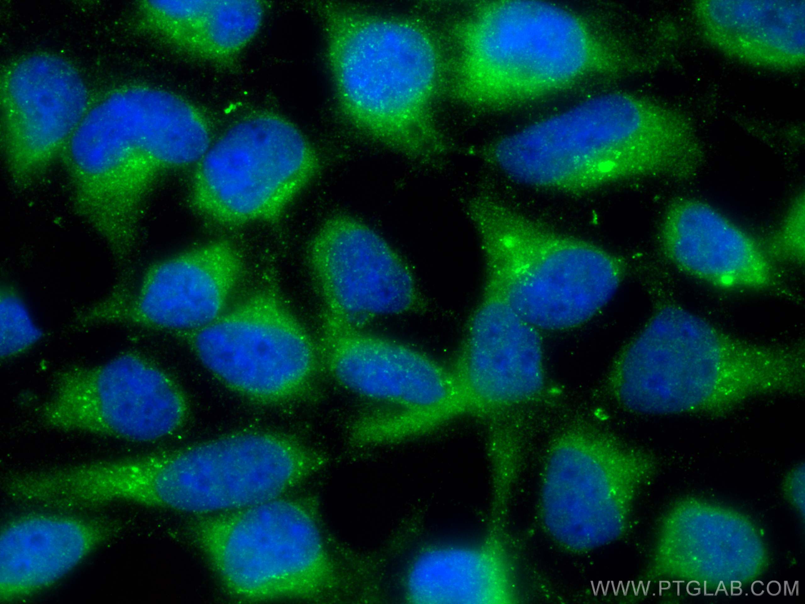 Immunofluorescence (IF) / fluorescent staining of HEK-293 cells using ARHGEF18 Polyclonal antibody (11243-1-AP)