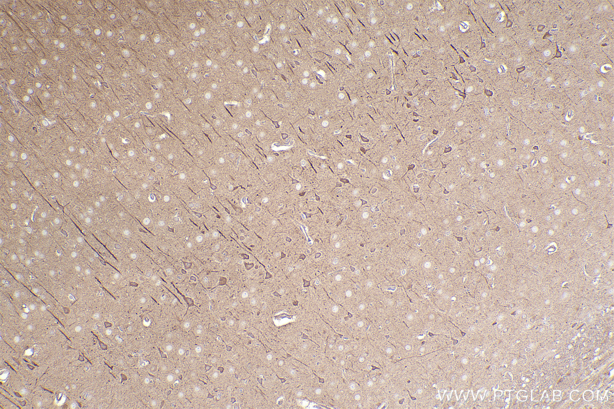 Immunohistochemistry (IHC) staining of rat brain tissue using ARHGEF7 Polyclonal antibody (14092-1-AP)