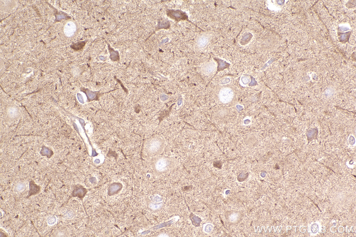 Immunohistochemistry (IHC) staining of rat brain tissue using ARHGEF7 Polyclonal antibody (14092-1-AP)