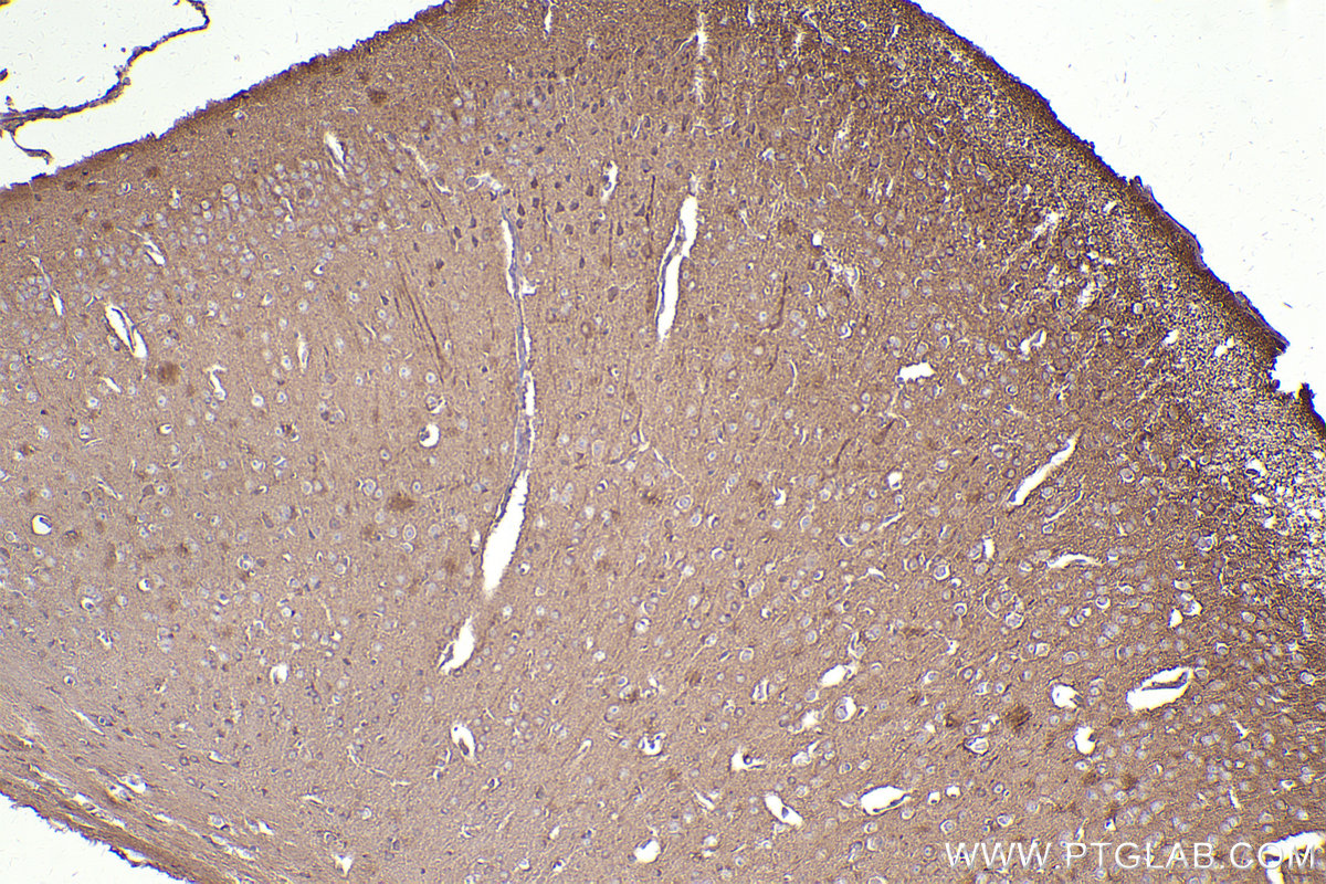 Immunohistochemistry (IHC) staining of mouse brain tissue using ARHGEF7 Polyclonal antibody (14092-1-AP)