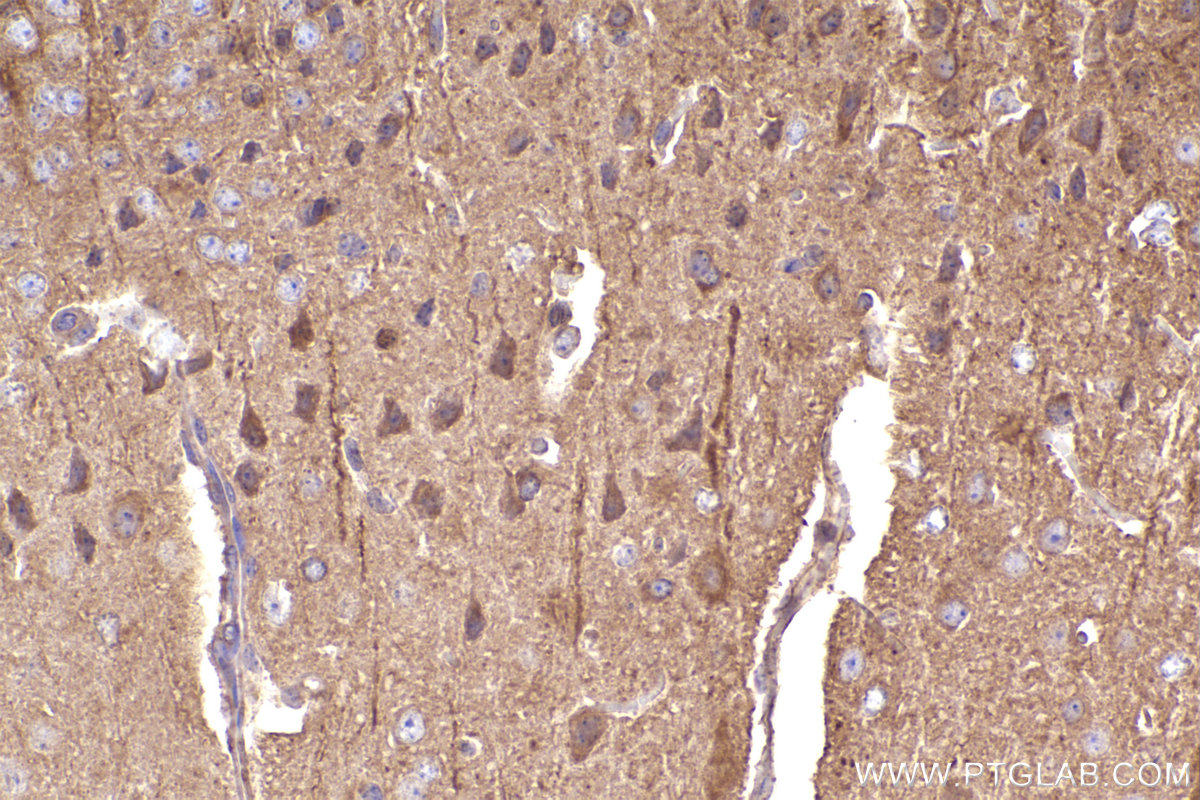 Immunohistochemistry (IHC) staining of mouse brain tissue using ARHGEF7 Polyclonal antibody (14092-1-AP)