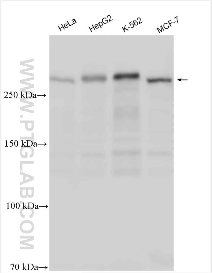 Western Blot (WB) analysis of various lysates using ARID1A Polyclonal antibody (30304-1-AP)