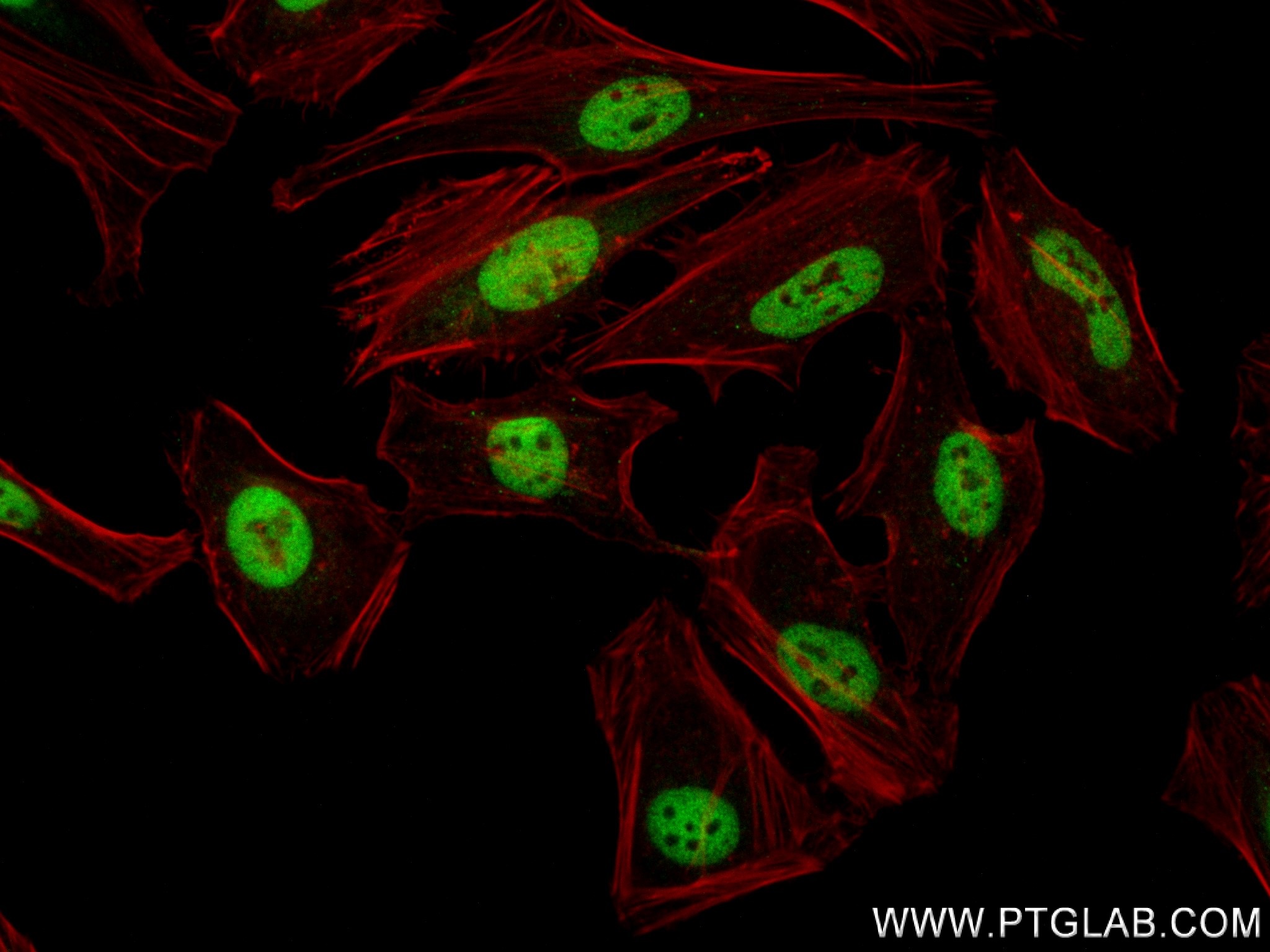 Immunofluorescence (IF) / fluorescent staining of HeLa cells using ARID1A Recombinant antibody (83733-3-RR)