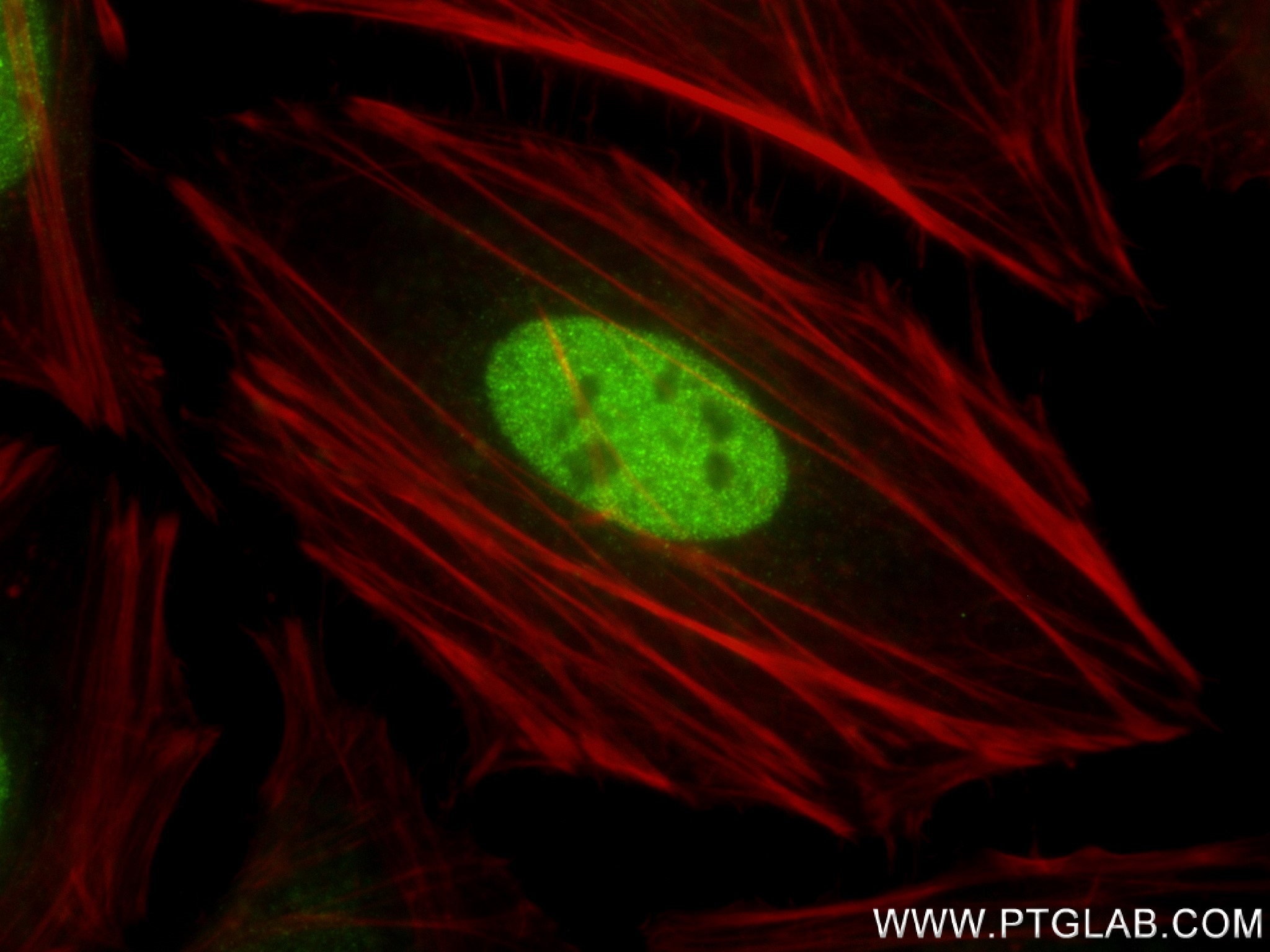 Immunofluorescence (IF) / fluorescent staining of HeLa cells using ARID1A Recombinant antibody (83733-3-RR)