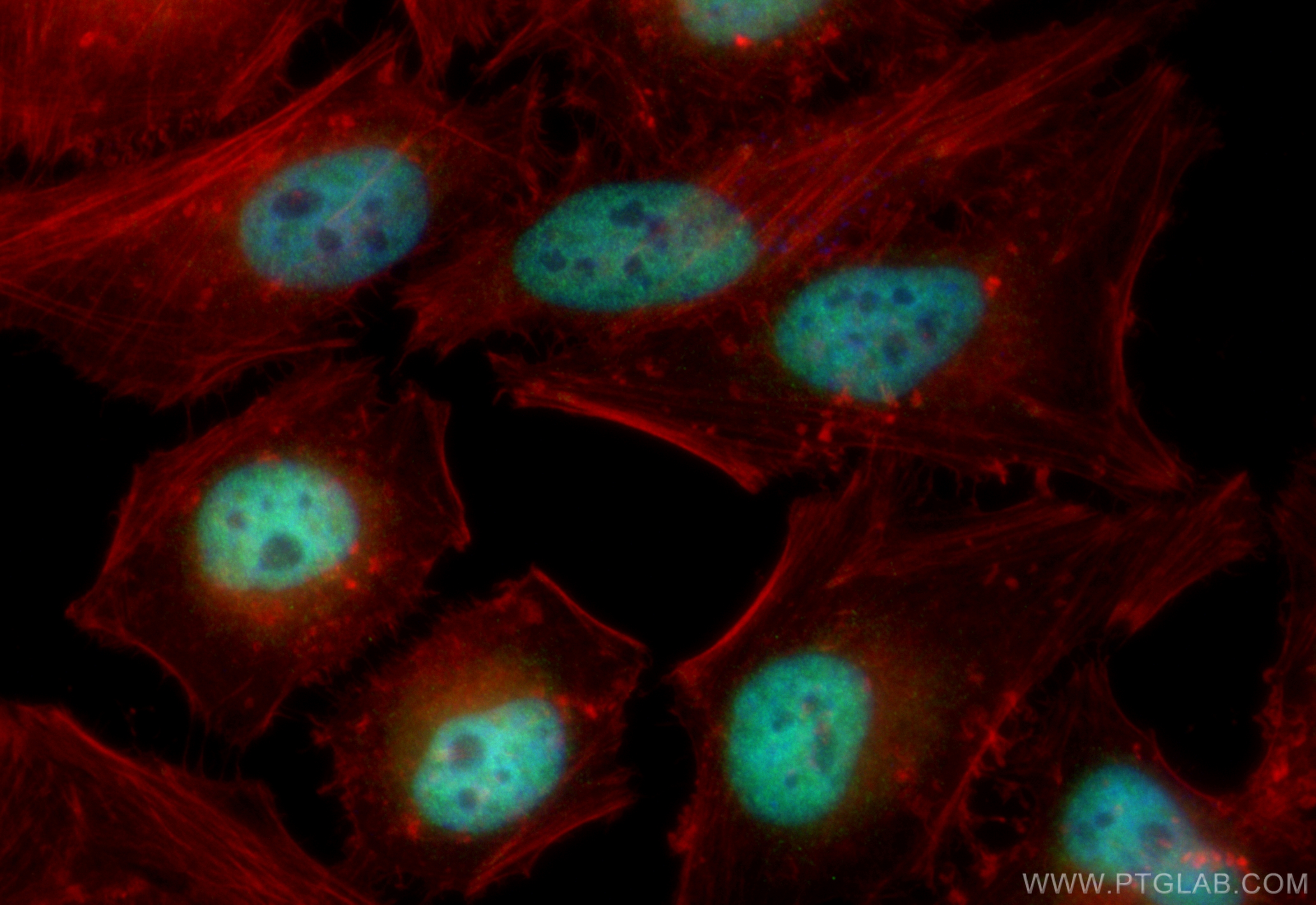 Immunofluorescence (IF) / fluorescent staining of HeLa cells using CoraLite® Plus 488-conjugated ARID1A Recombinant a (CL488-83733-3)