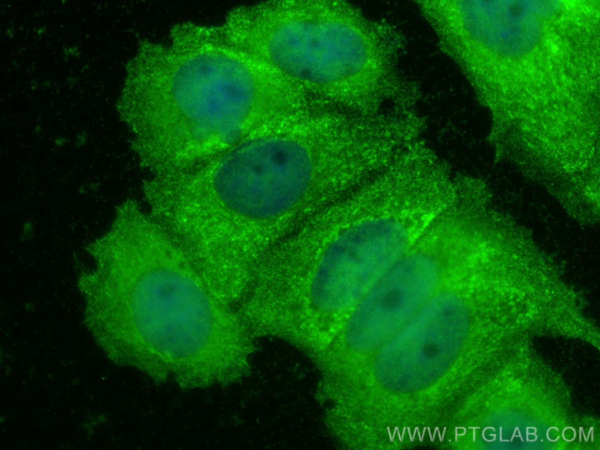 Immunofluorescence (IF) / fluorescent staining of MCF-7 cells using ARID4B Polyclonal antibody (24499-1-AP)