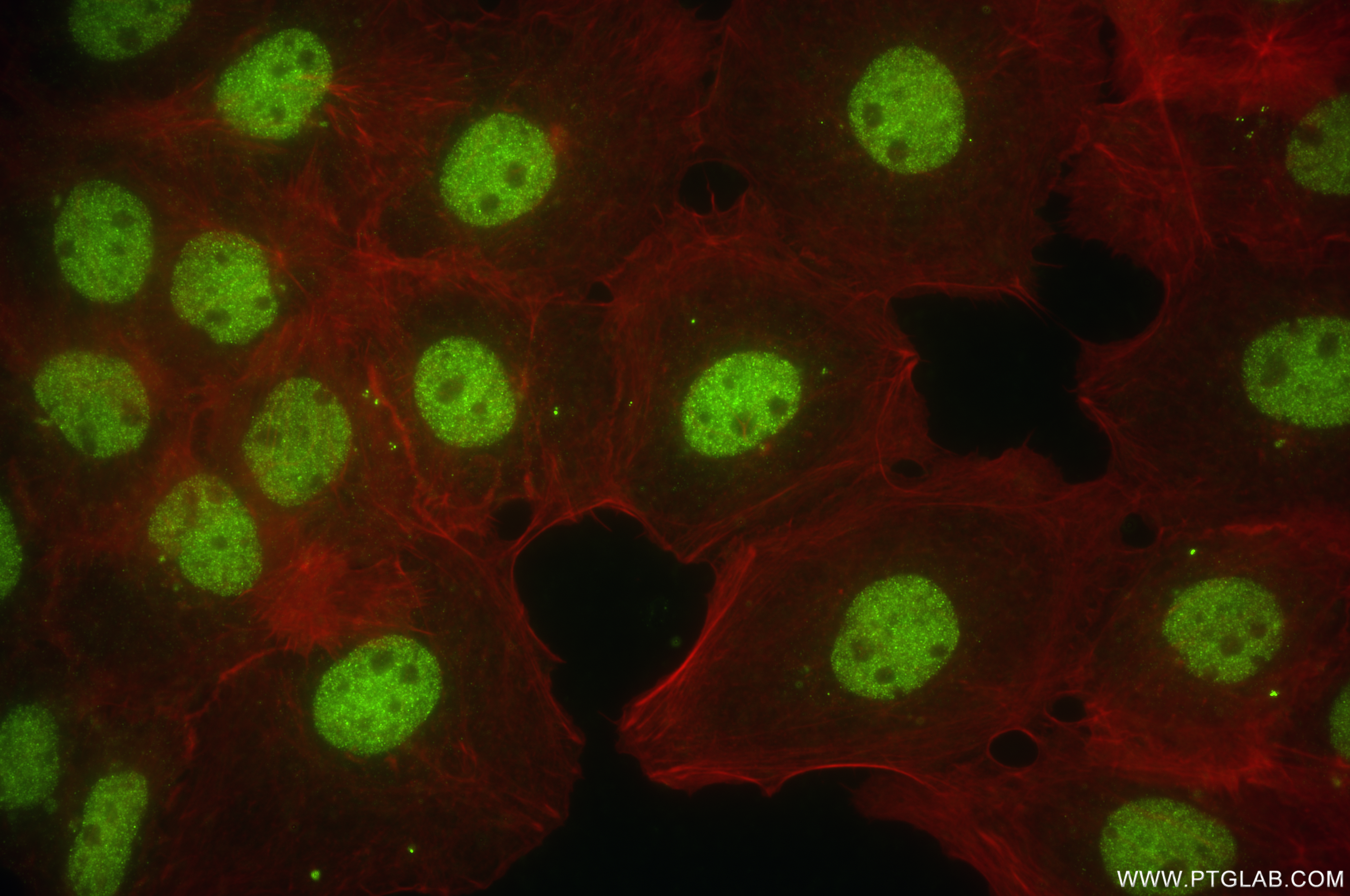 Immunofluorescence (IF) / fluorescent staining of A431 cells using ARK5 Recombinant antibody (84893-5-RR)