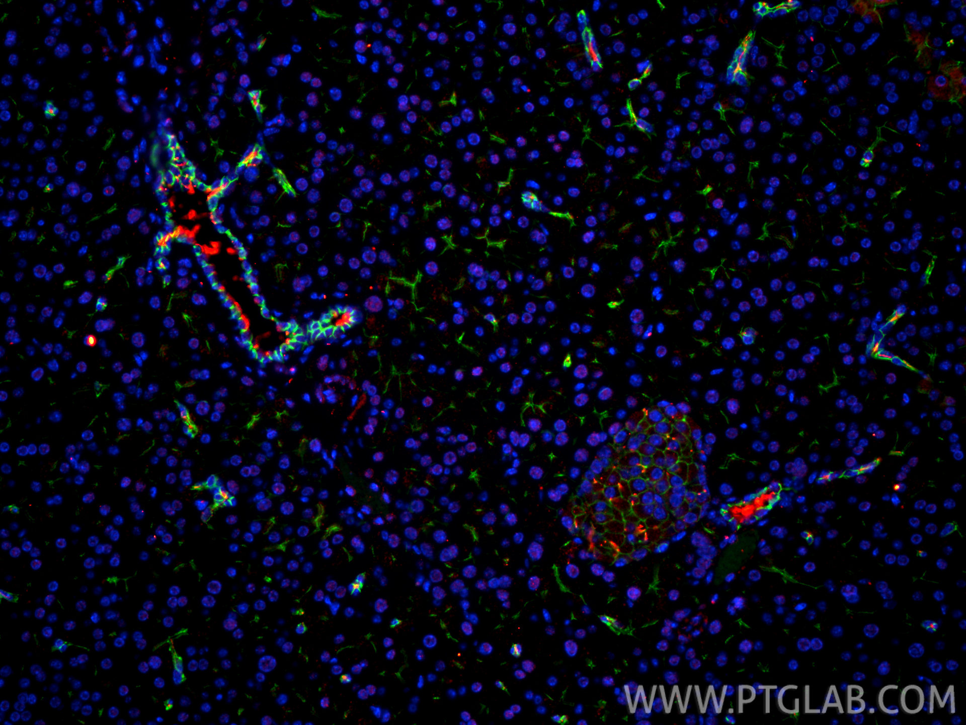 Immunofluorescence (IF) / fluorescent staining of mouse pancreas tissue using ARL13B Polyclonal antibody (17711-1-AP)