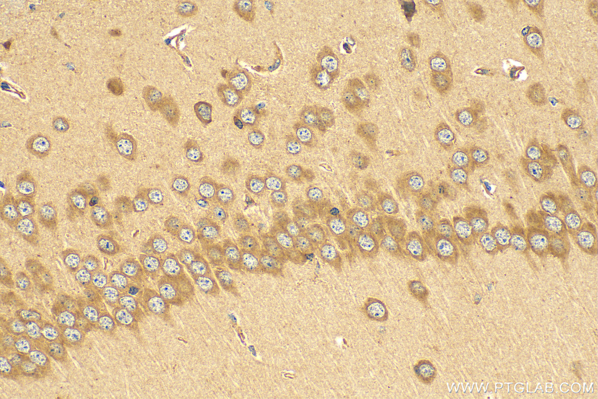 Immunohistochemistry (IHC) staining of mouse brain tissue using ARL13B Polyclonal antibody (17711-1-AP)