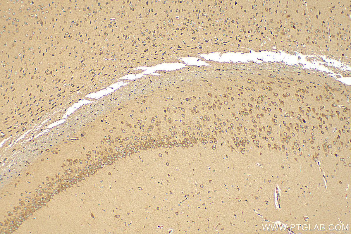 Immunohistochemistry (IHC) staining of mouse brain tissue using ARL13B Polyclonal antibody (17711-1-AP)