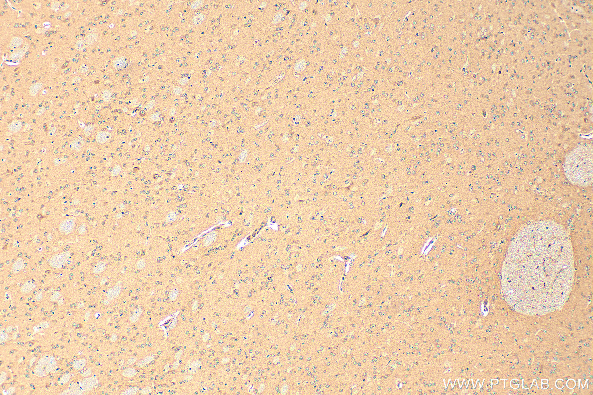 Immunohistochemistry (IHC) staining of mouse brain tissue using ARL13B Polyclonal antibody (17711-1-AP)