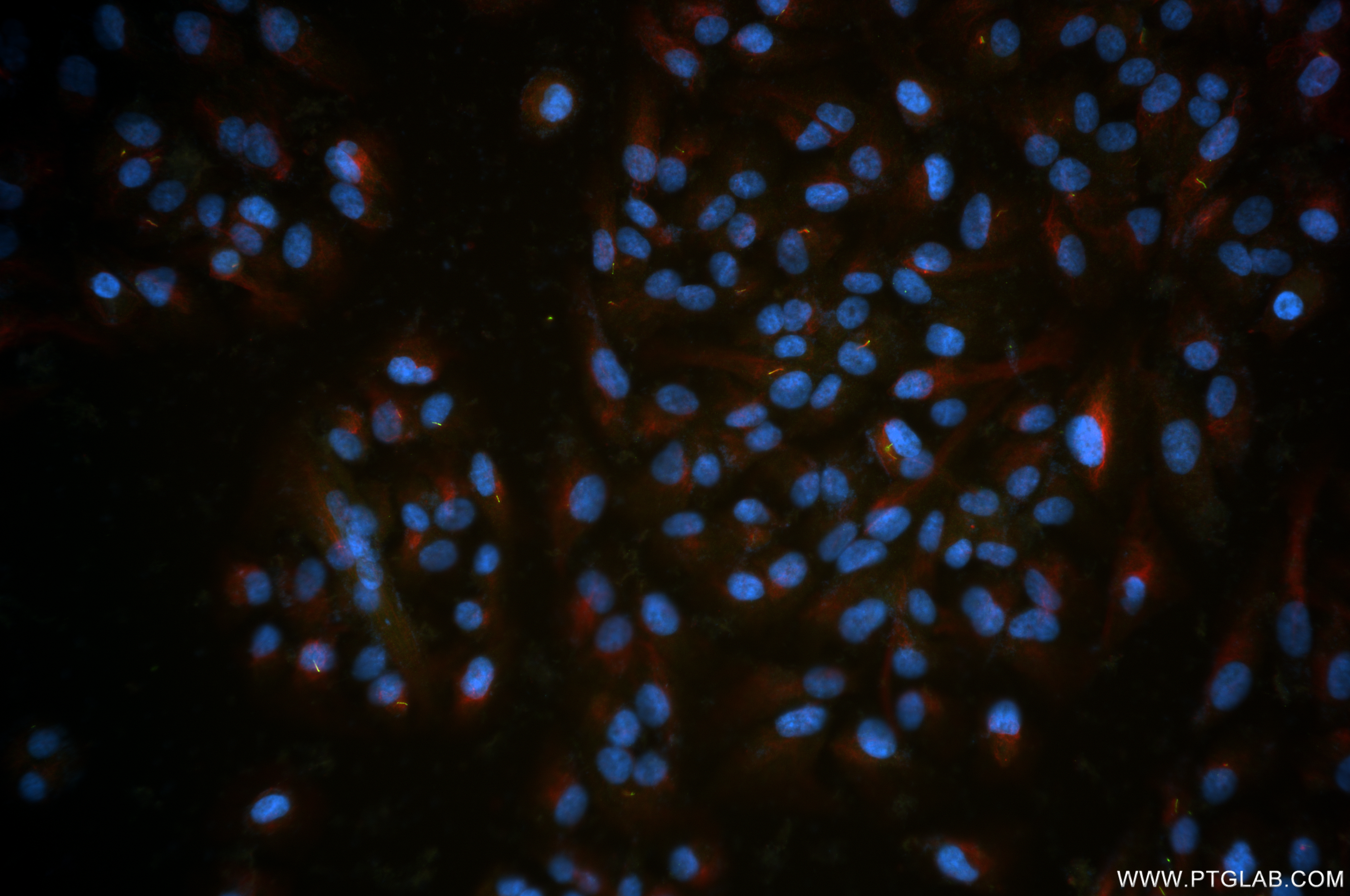 Immunofluorescence (IF) / fluorescent staining of hTERT-RPE1 cells using ARL13B Recombinant antibody (82834-2-RR)