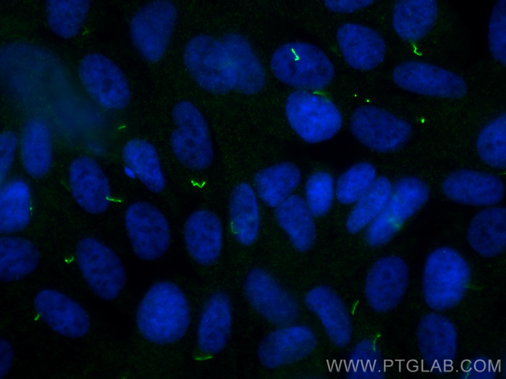 Immunofluorescence (IF) / fluorescent staining of hTERT-RPE1 cells using ARL13B Recombinant antibody (82834-2-RR)