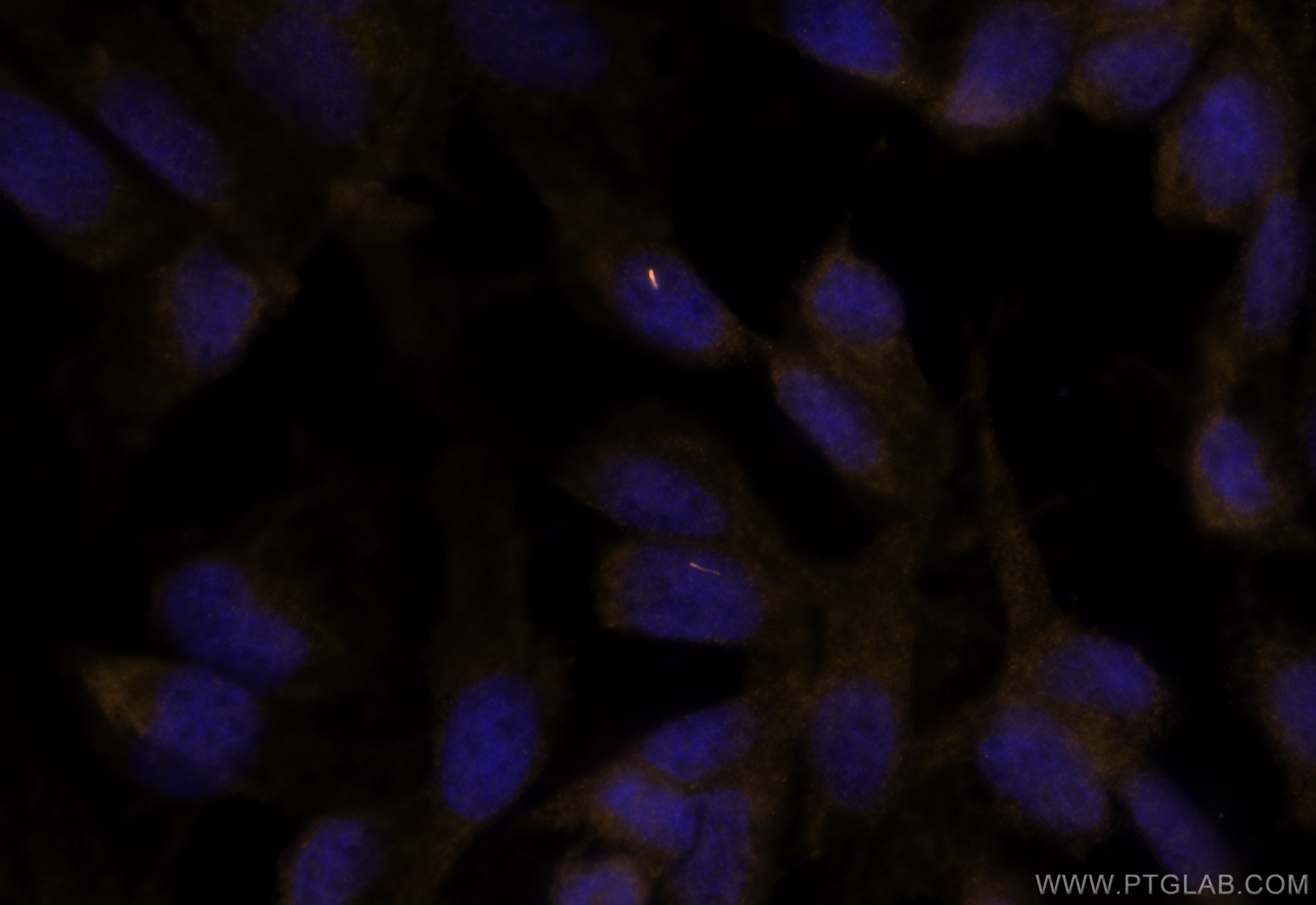 Immunofluorescence (IF) / fluorescent staining of MDCK cells using CoraLite® Plus 555-conjugated ARL13B Polyclonal an (CL555-17711)