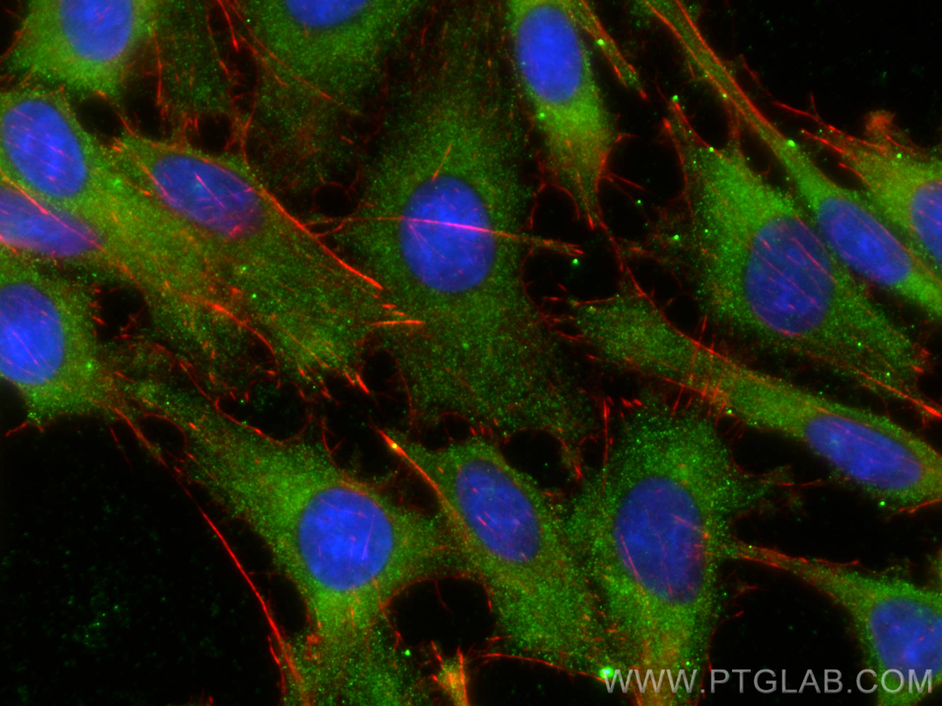 Immunofluorescence (IF) / fluorescent staining of C6 cells using ARL8A/ARL8B Monoclonal antibody (68186-1-Ig)