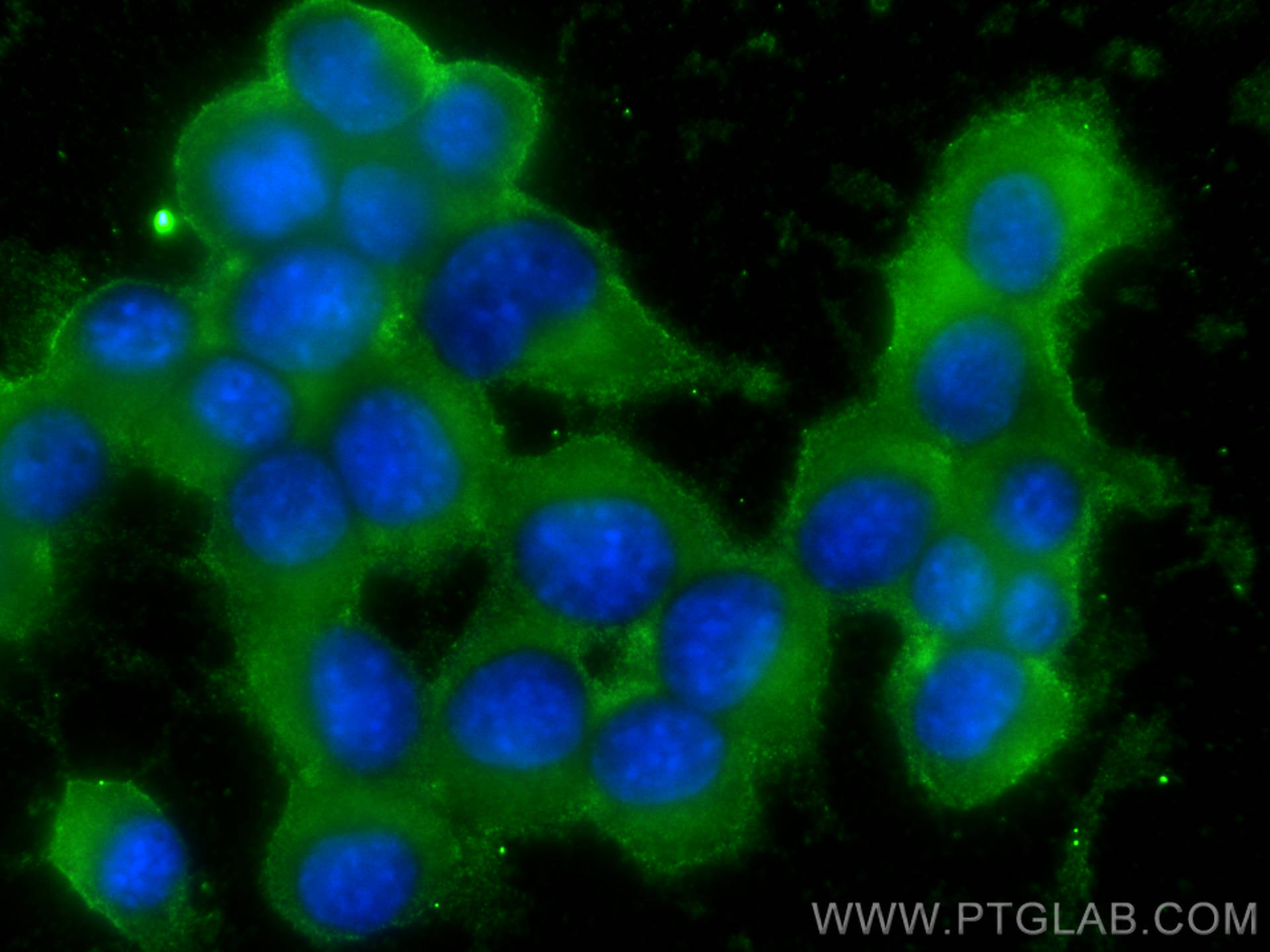 Immunofluorescence (IF) / fluorescent staining of Neuro-2a cells using ARL8A/ARL8B Monoclonal antibody (68186-1-Ig)