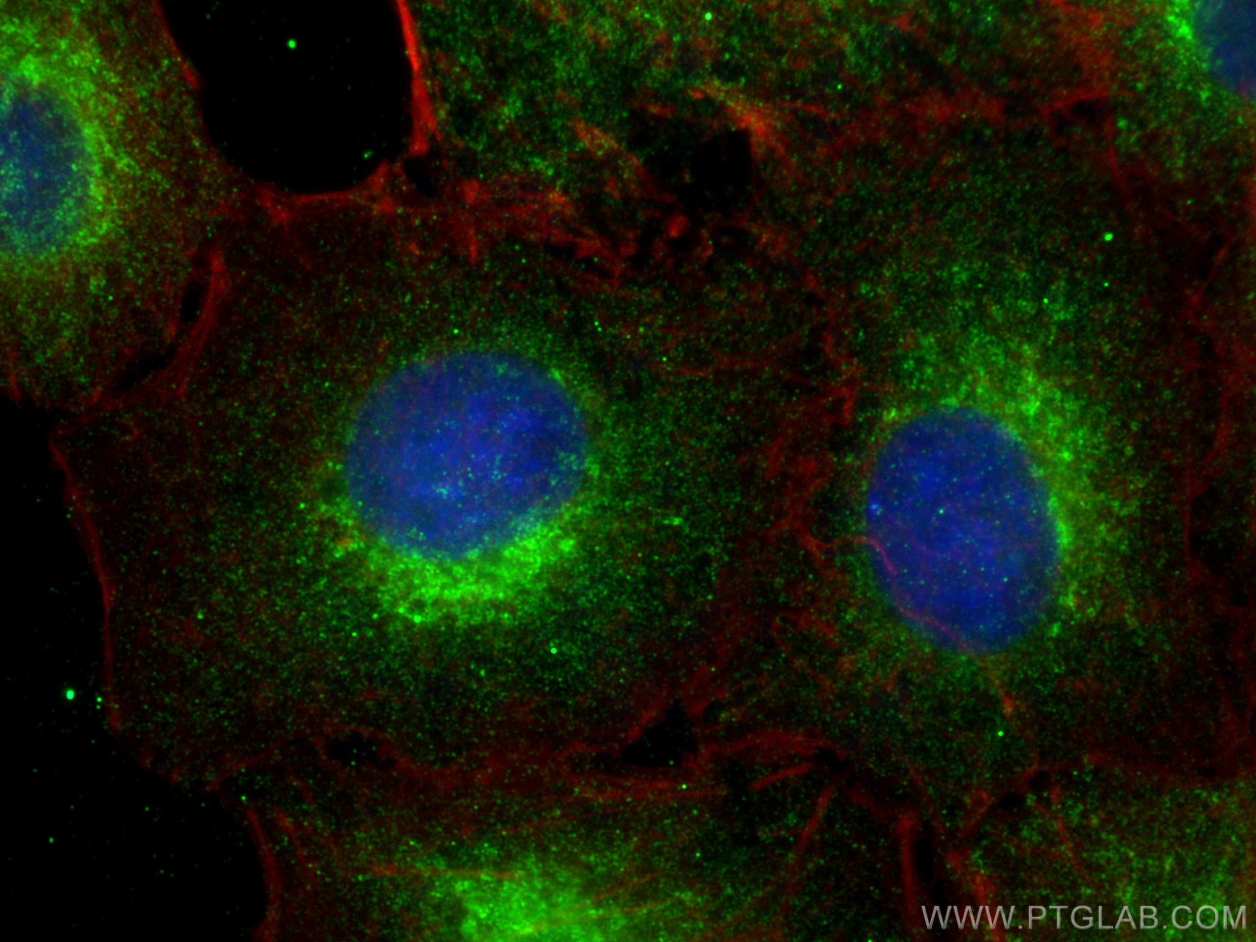 Immunofluorescence (IF) / fluorescent staining of A549 cells using ARL8A/ARL8B Monoclonal antibody (68186-1-Ig)