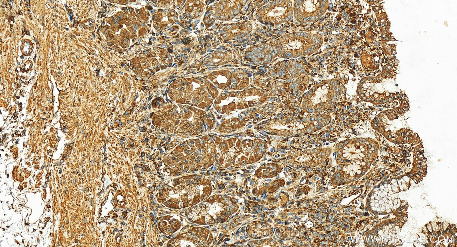 Immunohistochemistry (IHC) staining of human stomach tissue using ARL8A Polyclonal antibody (17060-1-AP)