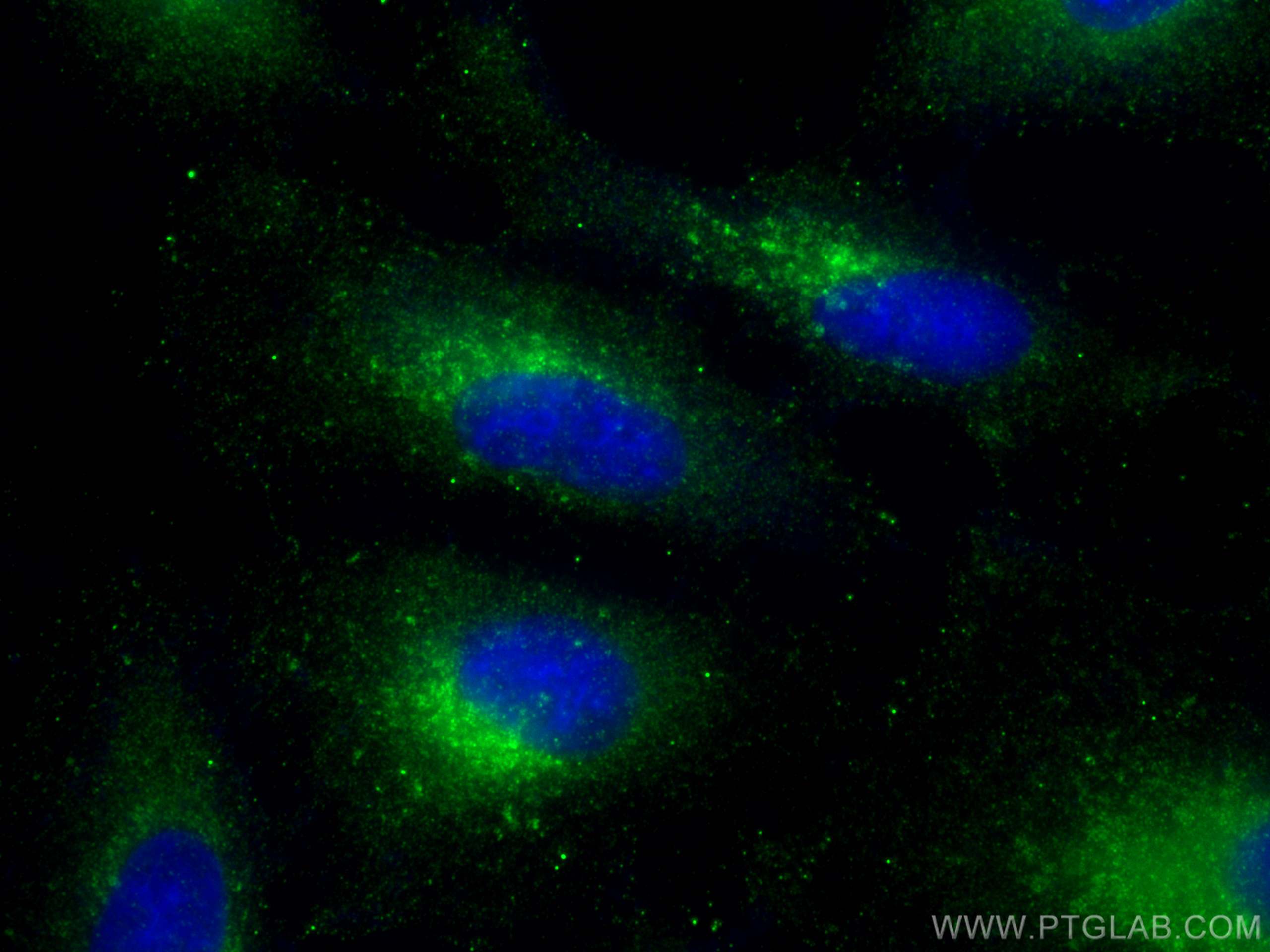 Immunofluorescence (IF) / fluorescent staining of A549 cells using ARL8B Polyclonal antibody (13049-1-AP)