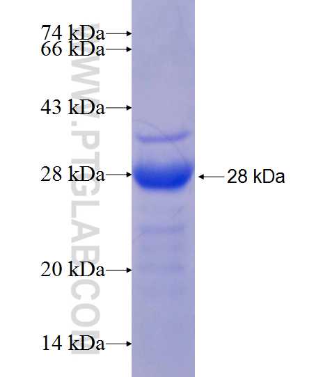 ARMC7 fusion protein Ag21179 SDS-PAGE