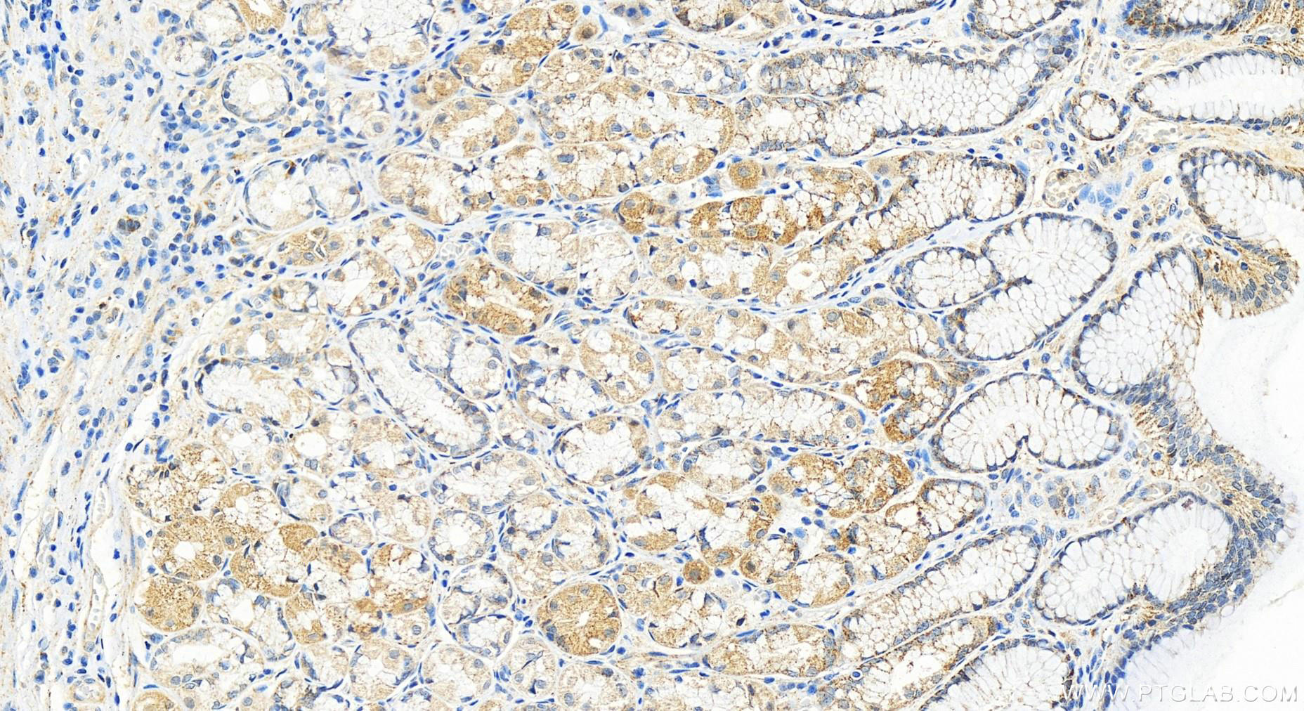 Immunohistochemistry (IHC) staining of human stomach tissue using ARMCX1 Polyclonal antibody (20193-1-AP)