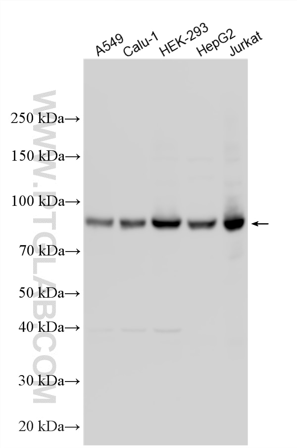 Western Blot (WB) analysis of various lysates using ARNT/HIF-1 beta Polyclonal antibody (14105-1-AP)