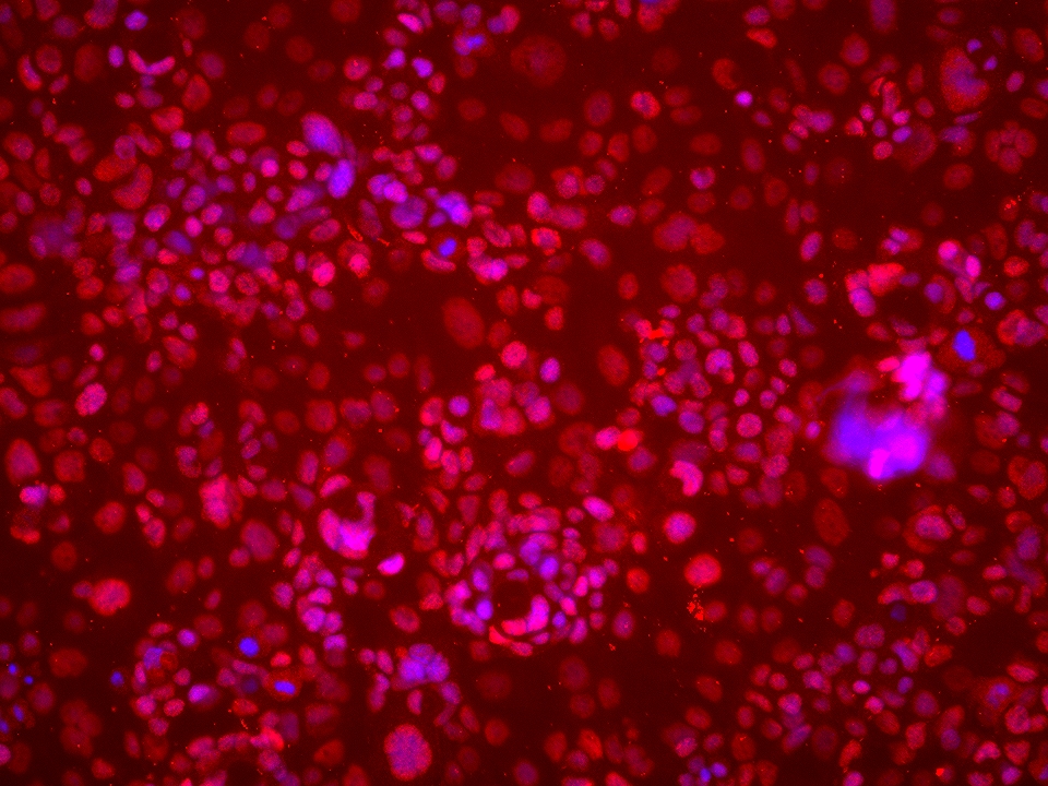 Immunofluorescence (IF) / fluorescent staining of HT-1376 cells using ARNT/HIF-1 beta Monoclonal antibody (66732-1-Ig)