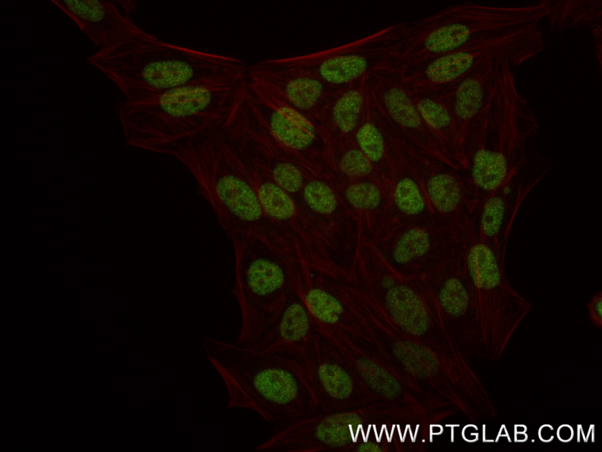 Immunofluorescence (IF) / fluorescent staining of HepG2 cells using ARNT/HIF-1 beta Recombinant antibody (84650-4-RR)