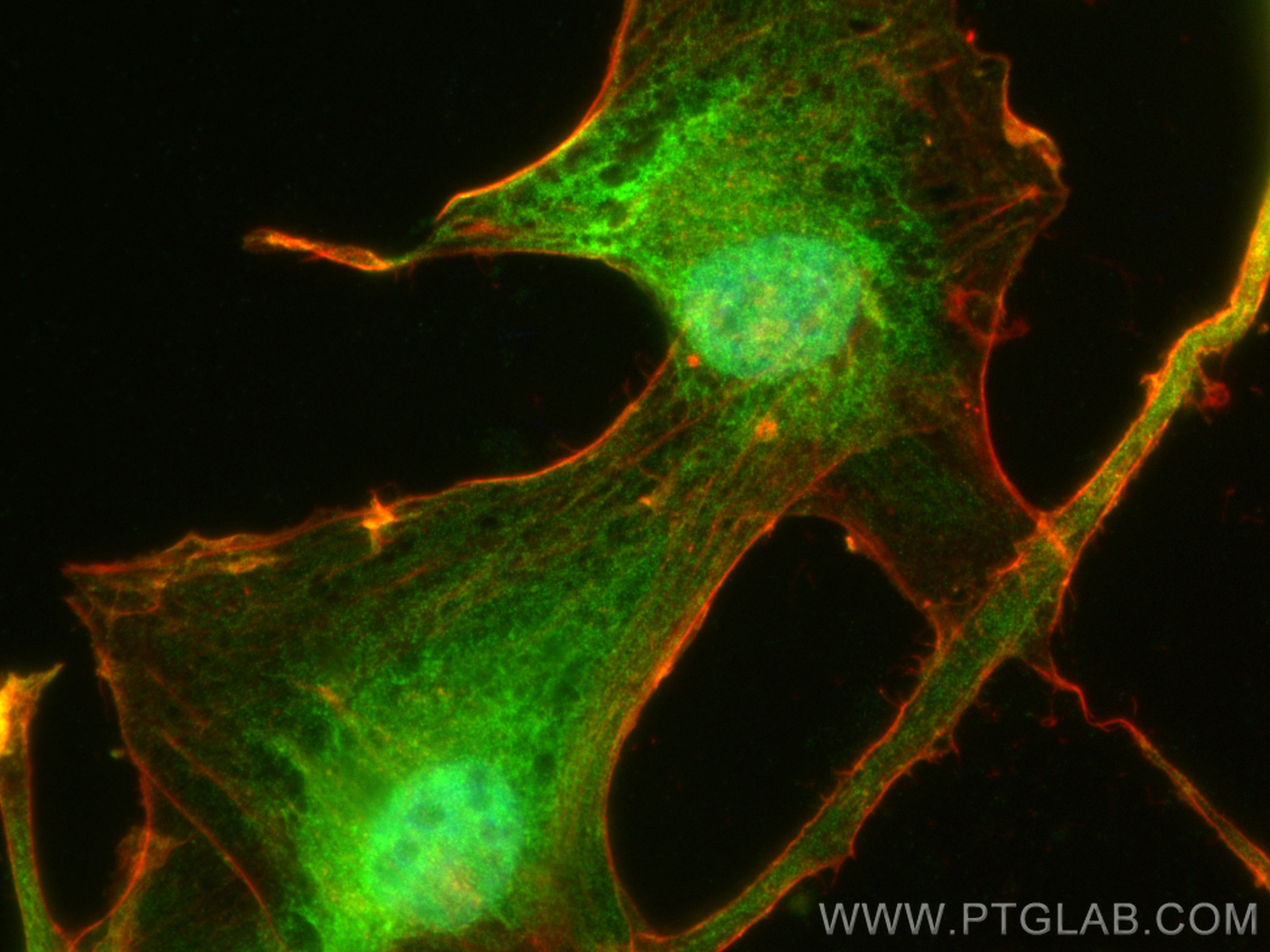 Immunofluorescence (IF) / fluorescent staining of U-87 MG cells using BMAL1 Polyclonal antibody (14268-1-AP)