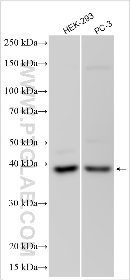 ARPC1A