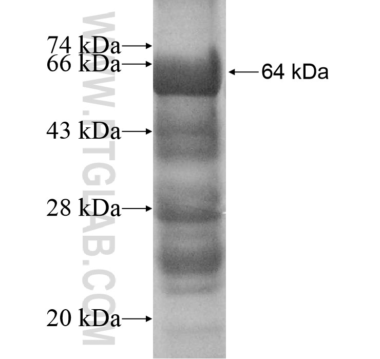 ARPC1A fusion protein Ag11593 SDS-PAGE