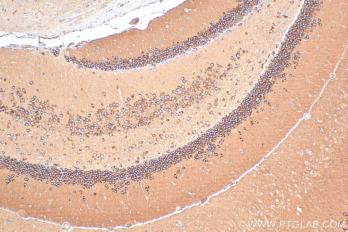 Immunohistochemistry (IHC) staining of mouse brain tissue using ARPC2 Polyclonal antibody (15058-1-AP)