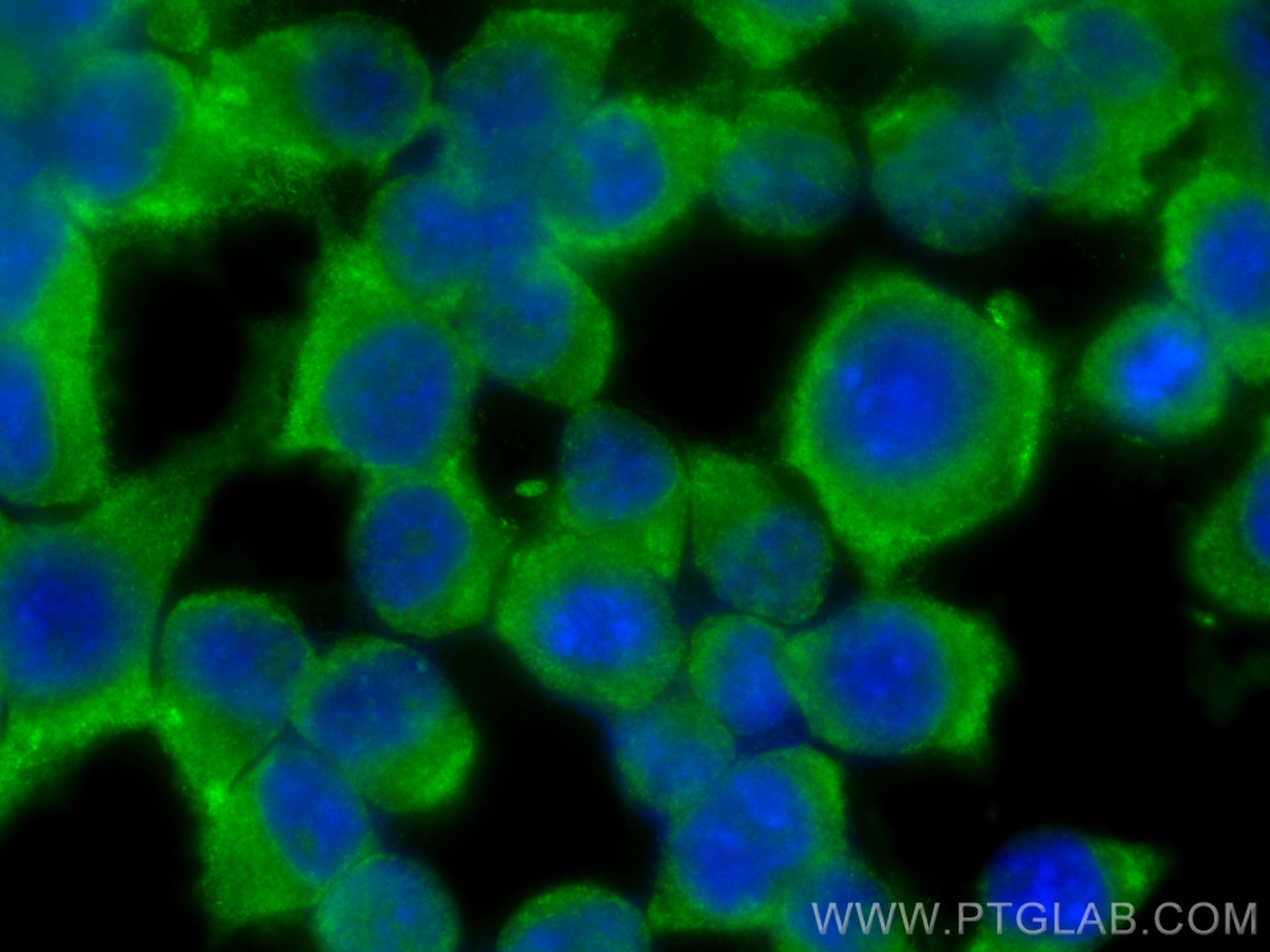 Immunofluorescence (IF) / fluorescent staining of Neuro-2a cells using ARPC5 Polyclonal antibody (16717-1-AP)