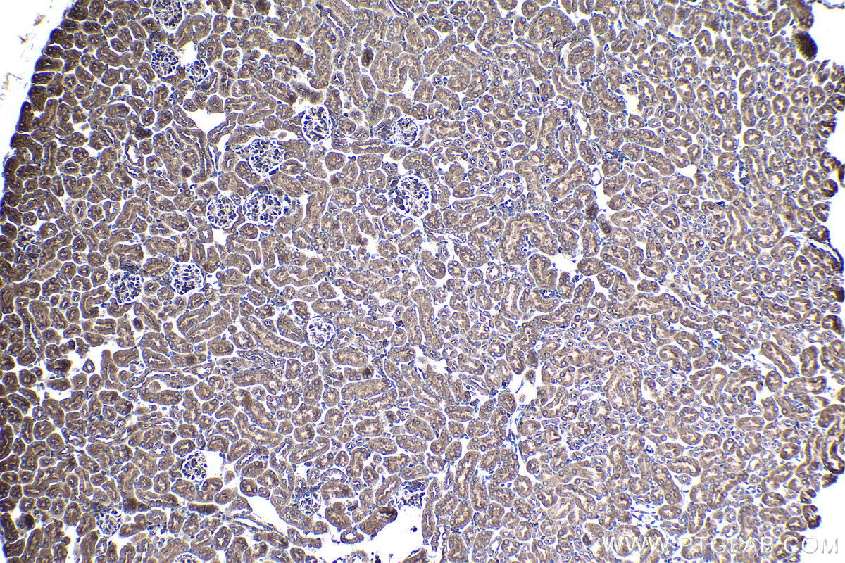 Immunohistochemistry (IHC) staining of mouse kidney tissue using ARPC5 Polyclonal antibody (16717-1-AP)