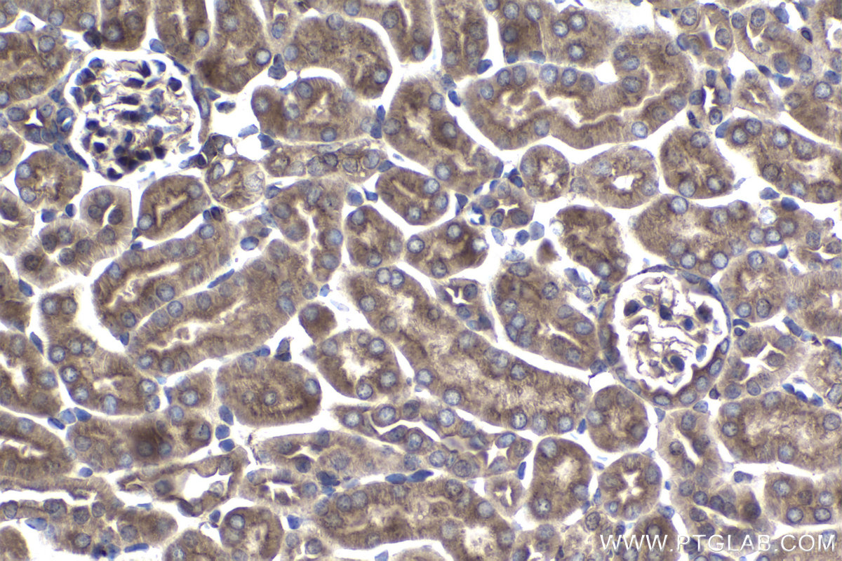 Immunohistochemistry (IHC) staining of mouse kidney tissue using ARPC5 Polyclonal antibody (16717-1-AP)