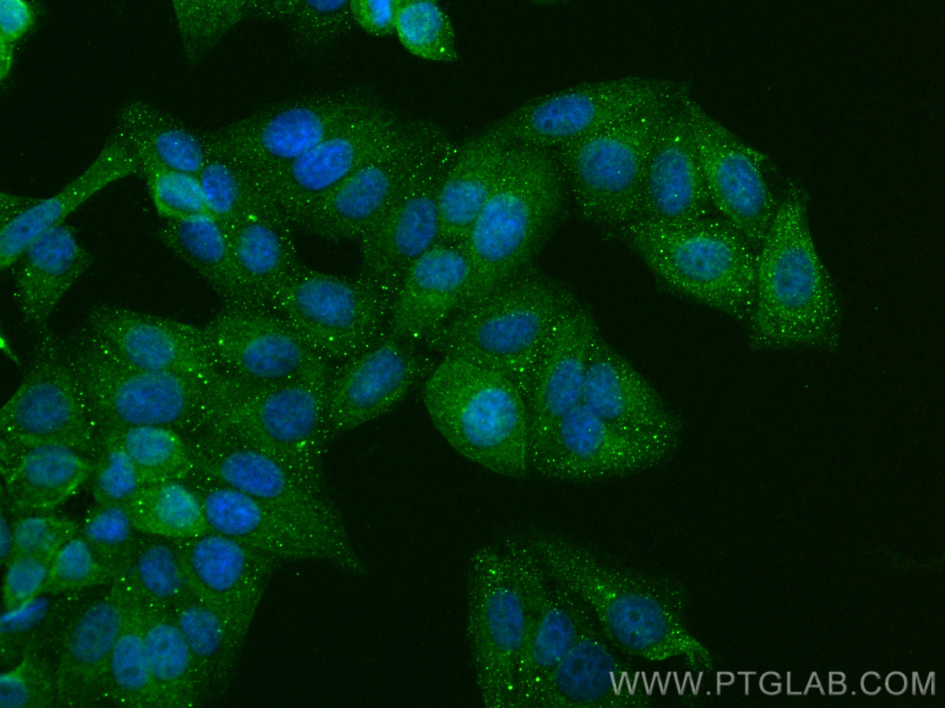 Immunofluorescence (IF) / fluorescent staining of HepG2 cells using ARSE Polyclonal antibody (31522-1-AP)