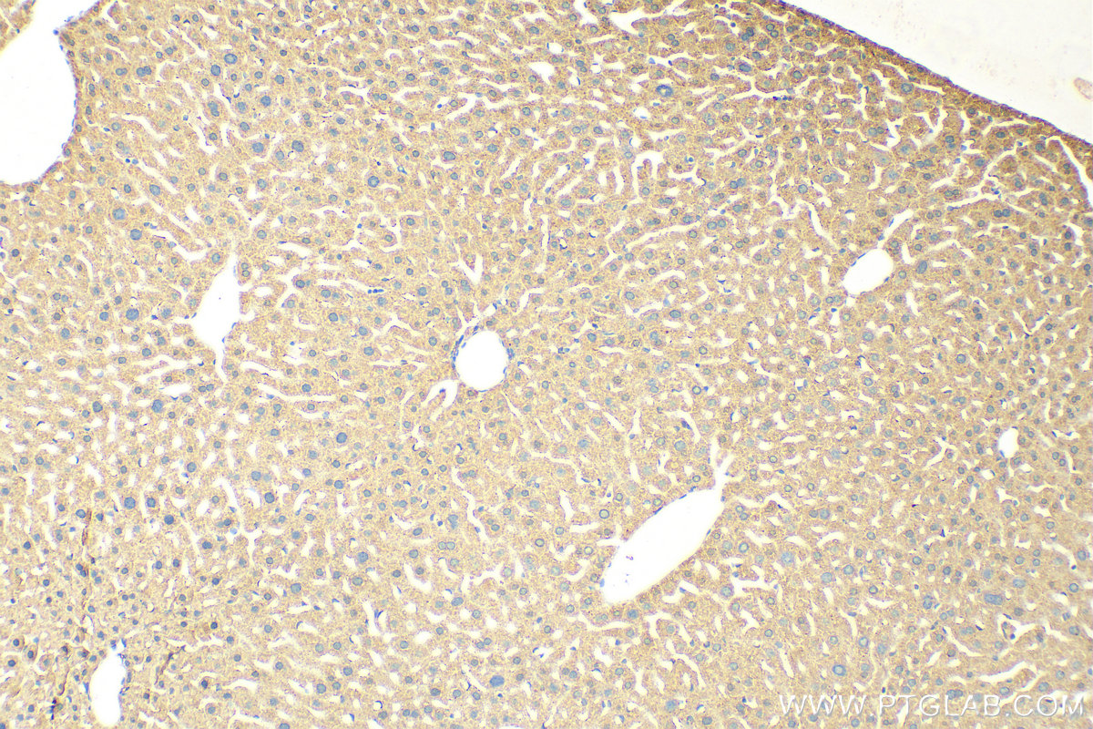 Immunohistochemistry (IHC) staining of mouse liver tissue using ARSE Polyclonal antibody (31522-1-AP)