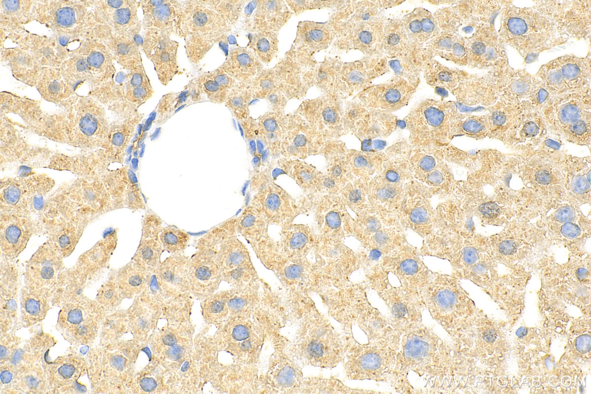 Immunohistochemistry (IHC) staining of mouse liver tissue using ARSE Polyclonal antibody (31522-1-AP)